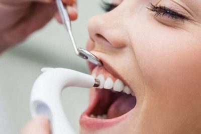 ультразвуковая чистка зубов